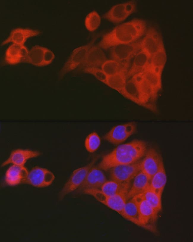 100UL ALDH1A1 ANTIBODY 100 ul