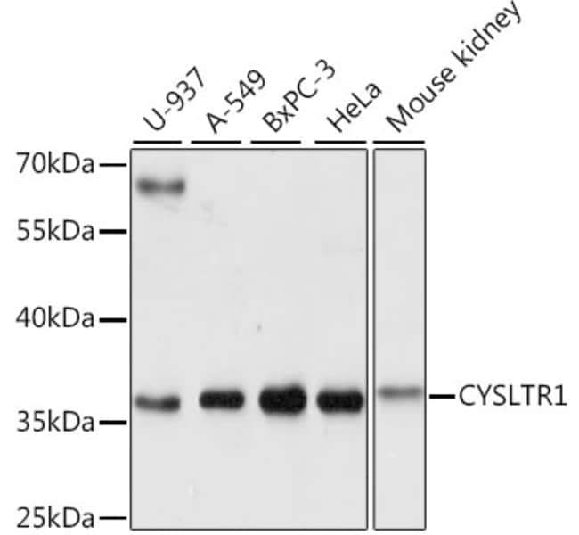 100UL CYSLTR1 ANTIBODY 100 ul
