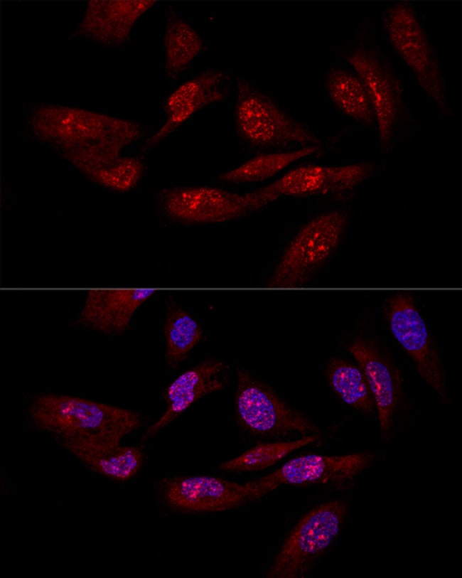100UL EIF6 ANTIBODY 100 ul