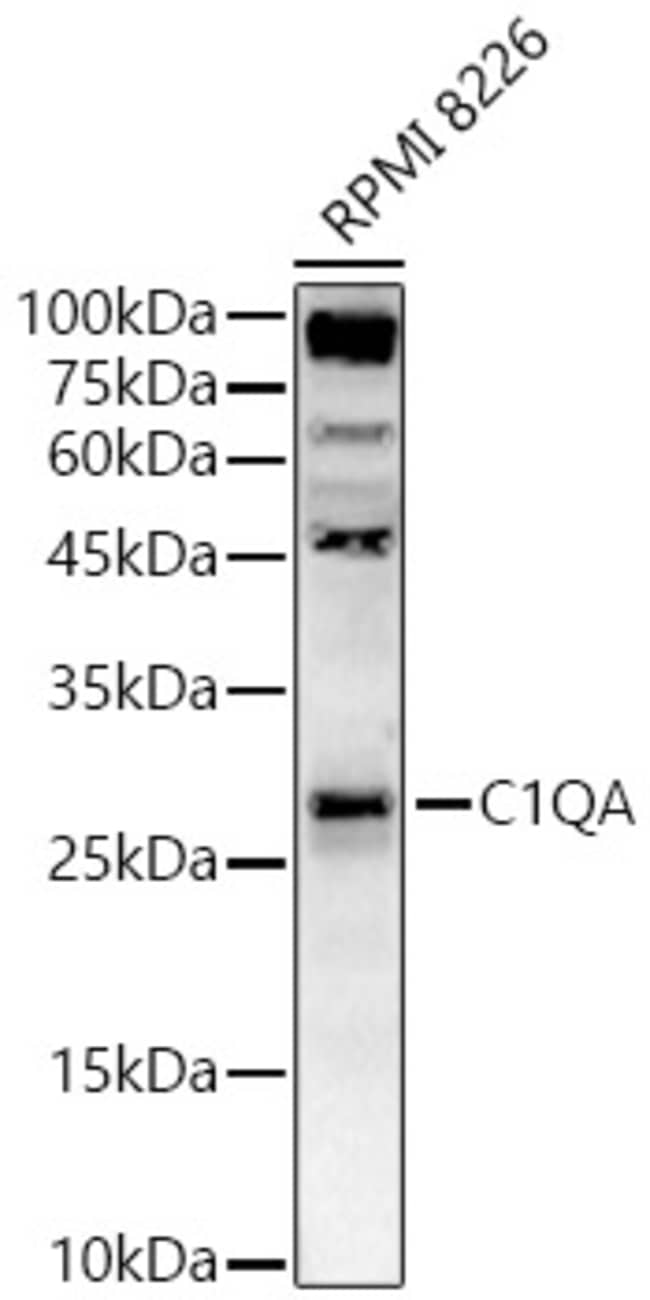 100UL C1Q ANTIBODY 100 ul