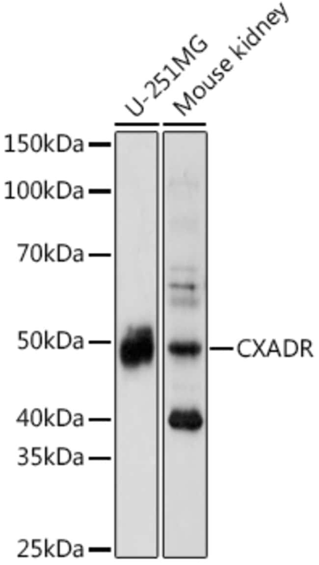 100UL CAR ANTIBODY 100 ul