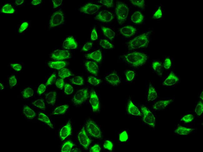 100UL HSD3B2 ANTIBODY 100 ul