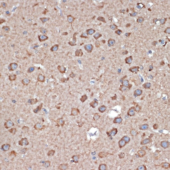 100UL GLUR1 ANTIBODY 100 ul