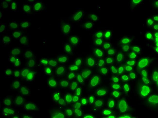 100UL HNRNP D ANTIBODY 100 ul