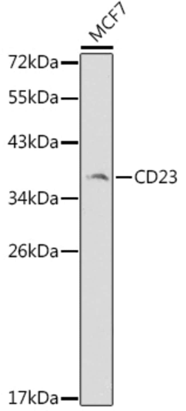 100UL CD23 ANTIBODY 100 ul