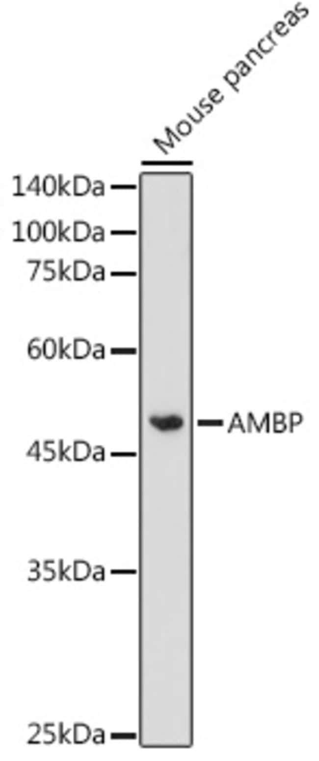 100UL ALPHA-1 MICROGLOBULIN ANTIBODY 100