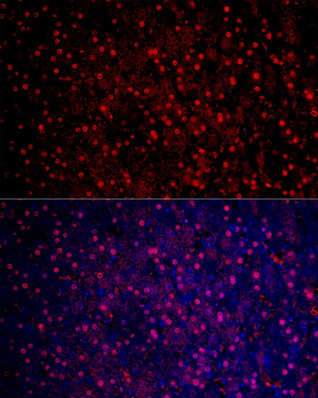 100UL ARGINASE 1 ANTIBODY 100 ul