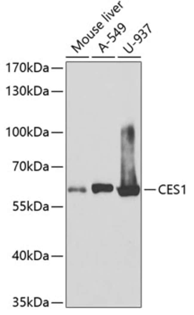 100UL CES1 ANTIBODY 100 ul