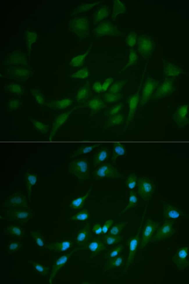 100UL DNA LIGASE I ANTIBODY 100 ul