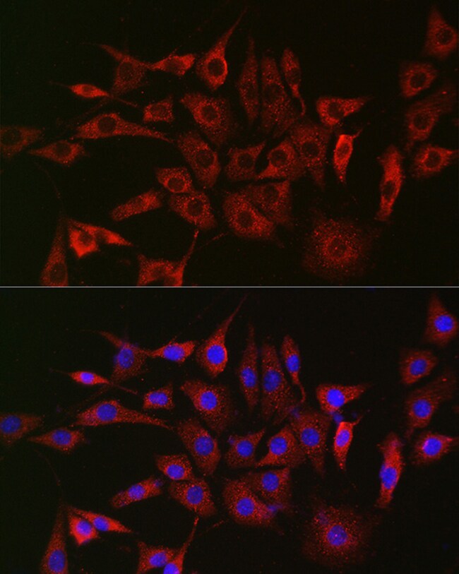 100UL GLB1 ANTIBODY 100 ul