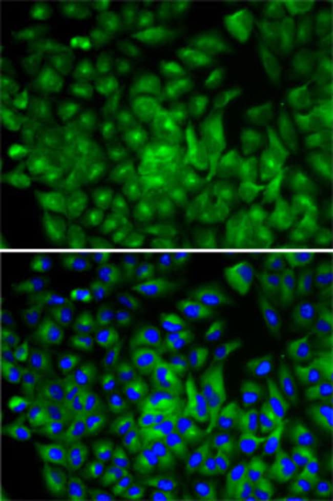 100UL ATG16L1 ANTIBODY 100 ul