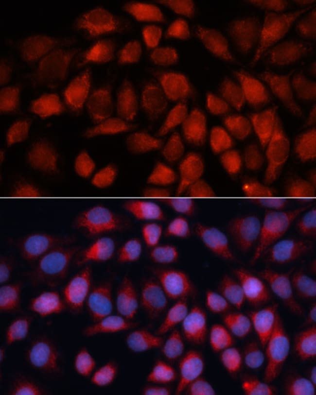 100UL ACADM ANTIBODY 100 ul