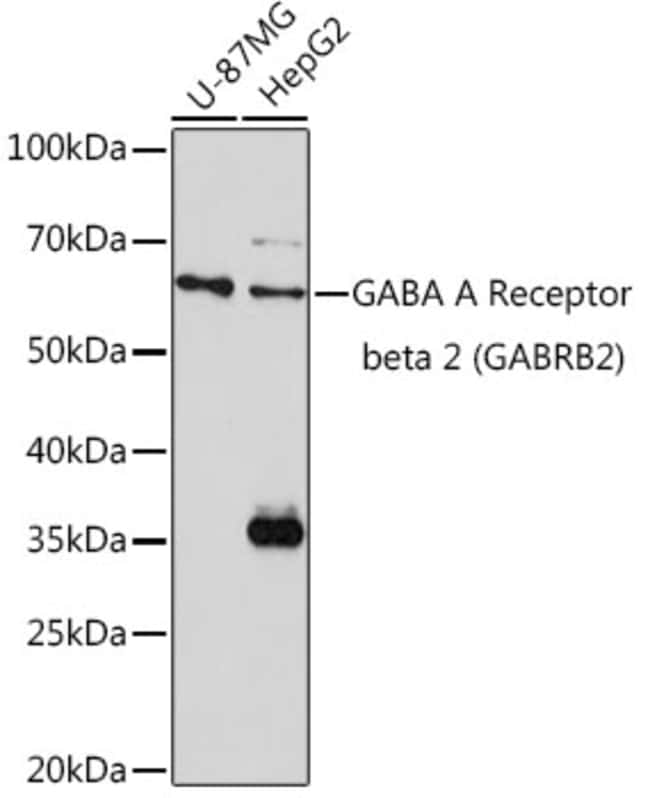 100UL GABRB2 ANTIBODY 100 ul