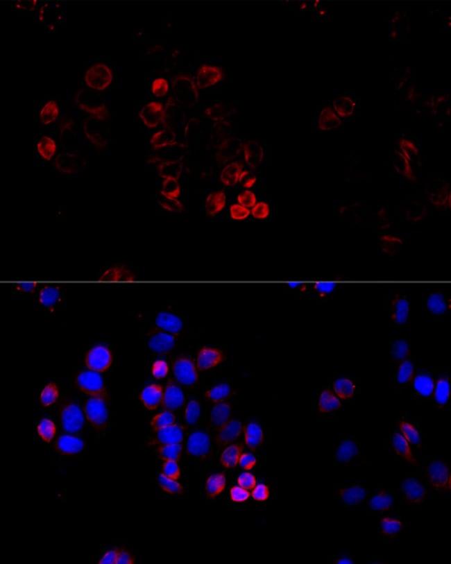 100UL ABCG8 ANTIBODY 100 ul