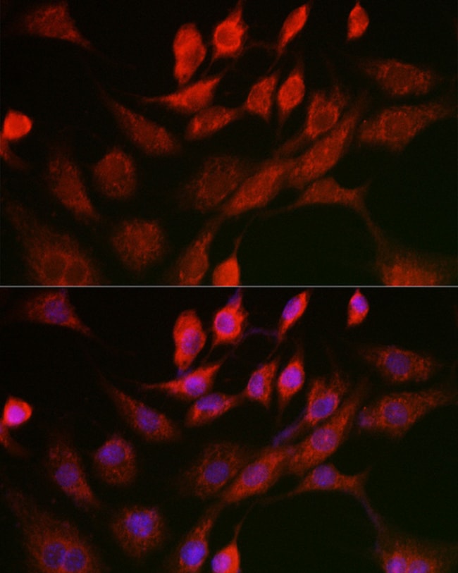 100UL ANT ANTIBODY 100 ul