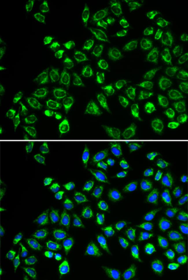 100UL C1QBP ANTIBODY 100 ul