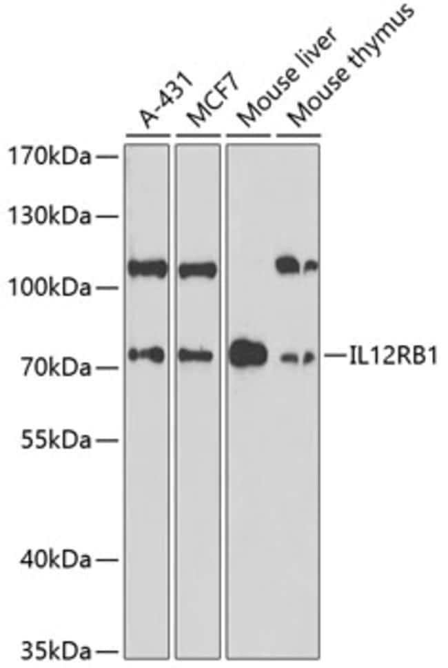 100UL IL12RB1 ANTIBODY 100 ul