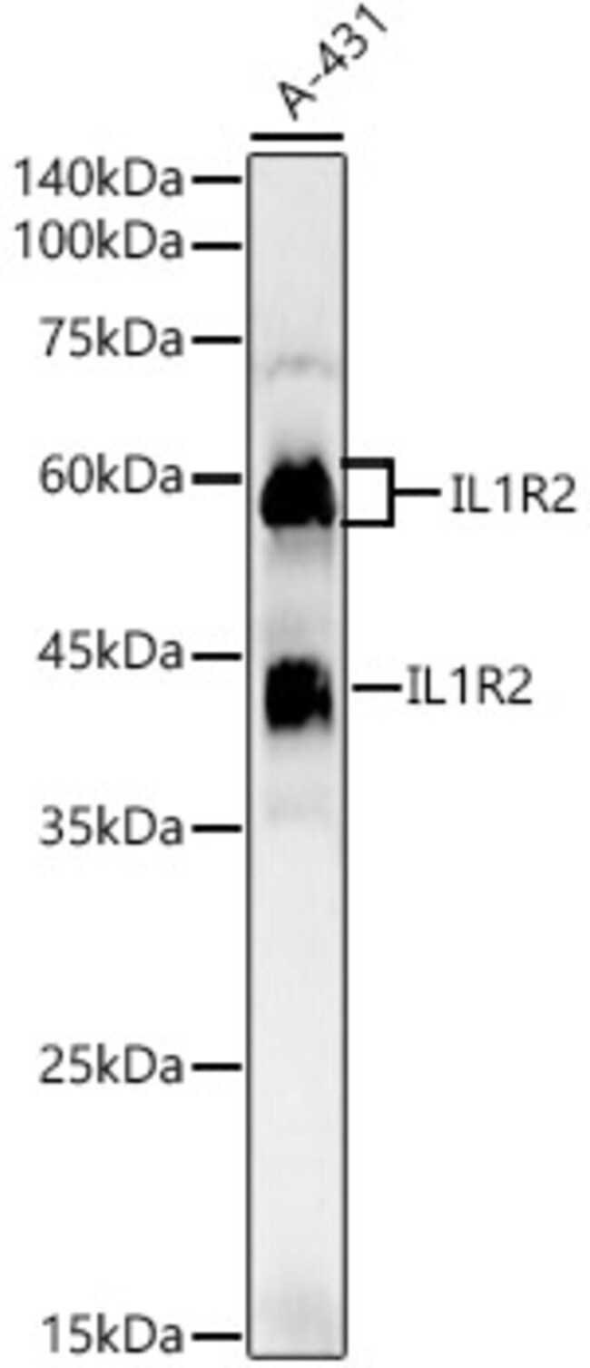 100UL IL1R2 ANTIBODY 100 ul