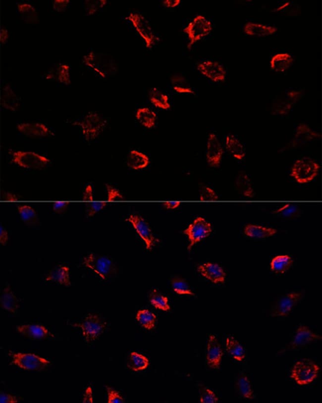100UL IL-11 ANTIBODY 100 ul