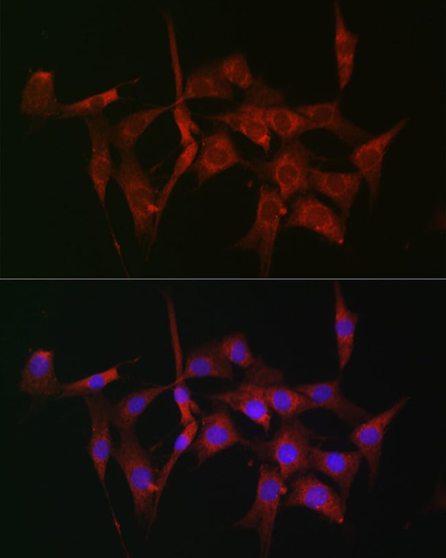 100UL FASCIN ANTIBODY 100 ul