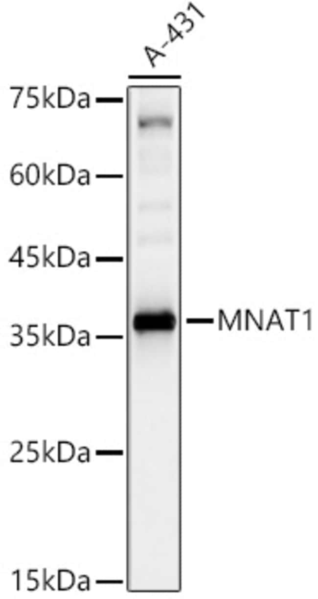 100UL MNAT1 ANTIBODY 100 ul