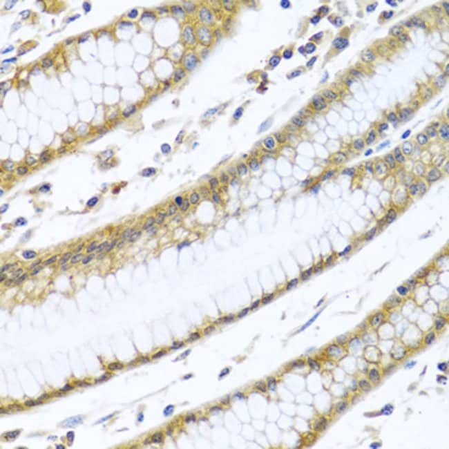 100UL GNAI3 ANTIBODY 100 ul