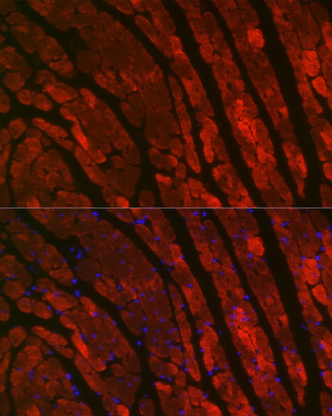 100UL CARDIAC TROPONIN C ANTIBODY 100 ul
