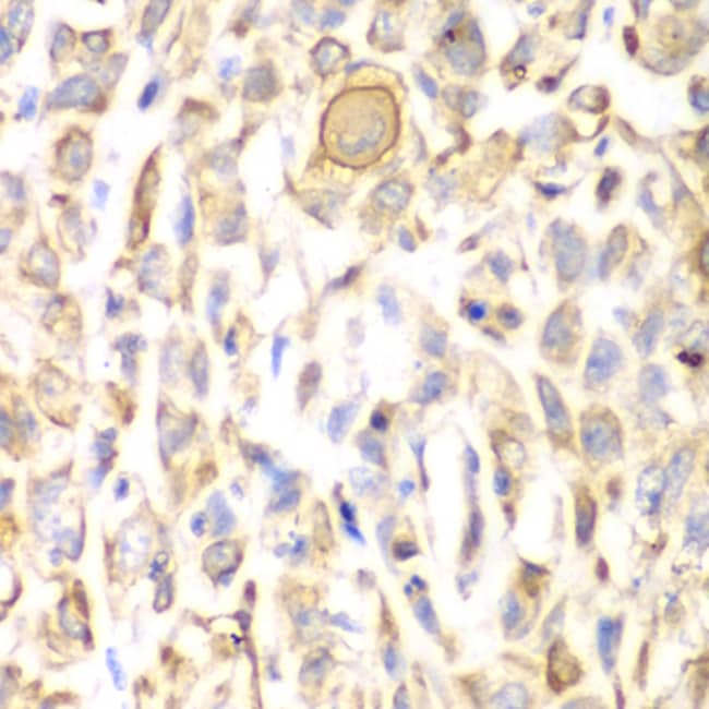 100UL CD151 ANTIBODY 100 ul