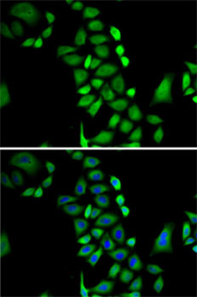 100UL GLO1 ANTIBODY 100 ul