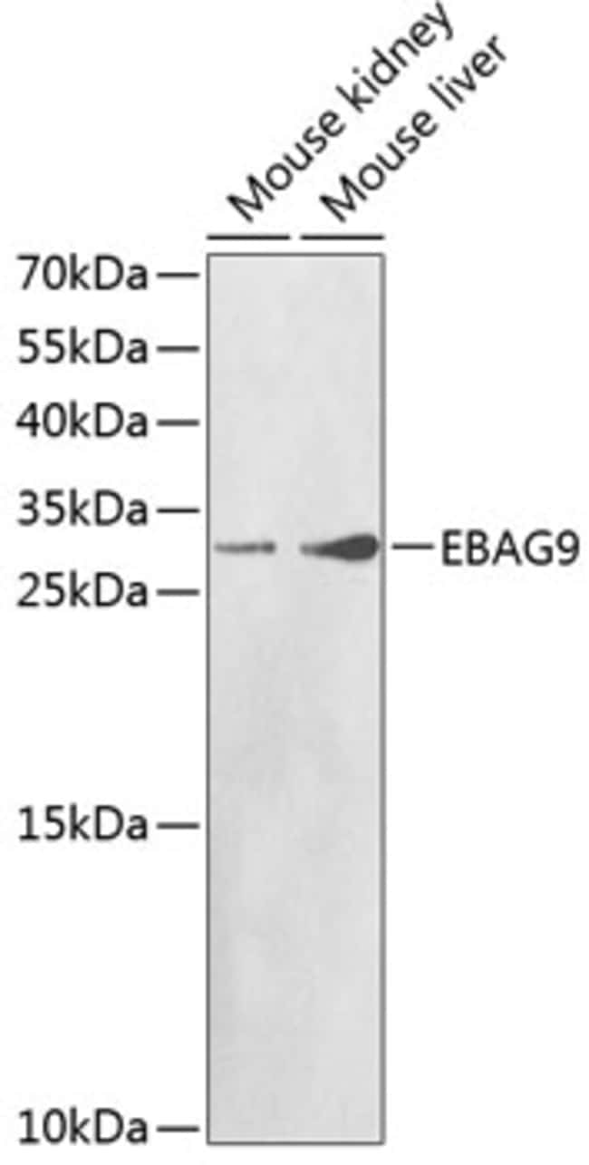 100UL EBAG9 ANTIBODY 100 ul