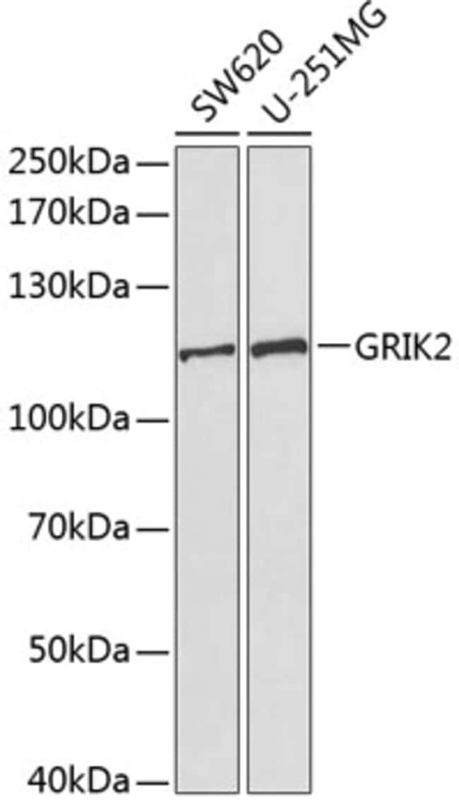 100UL GLUR6 ANTIBODY 100 ul