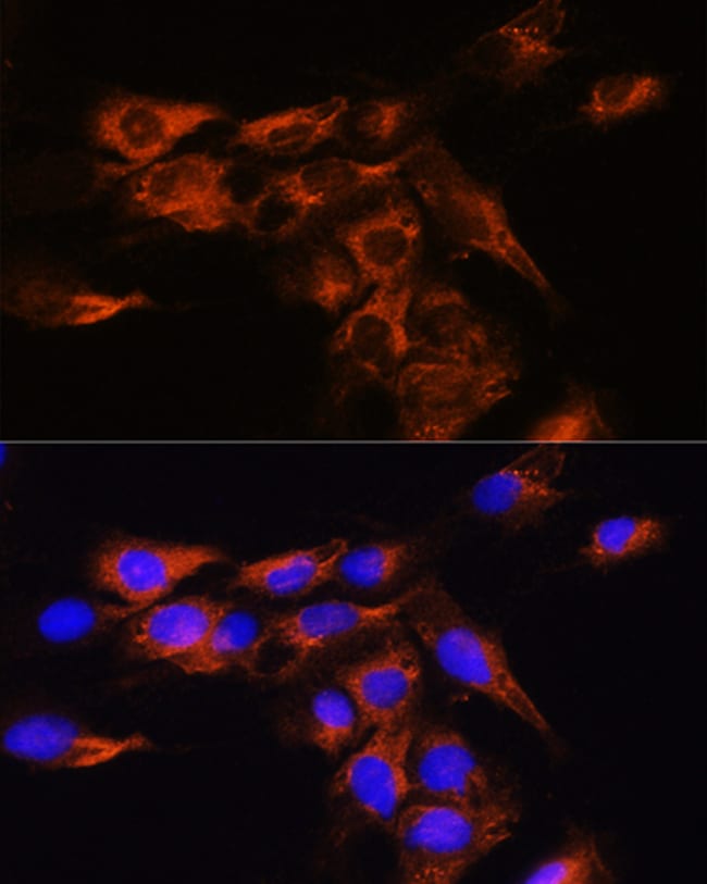 100UL ADORA2B ANTIBODY 100 ul
