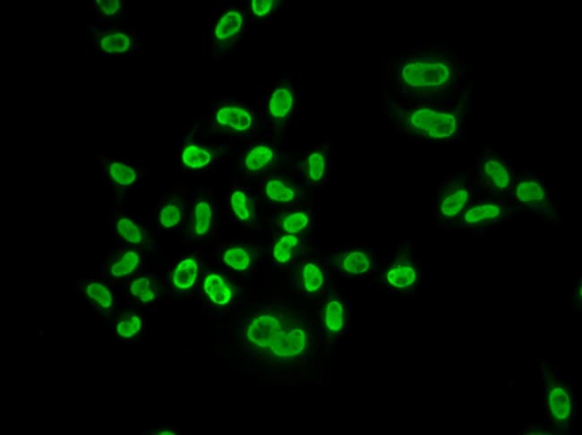 100UL MCM6 ANTIBODY 100 ul