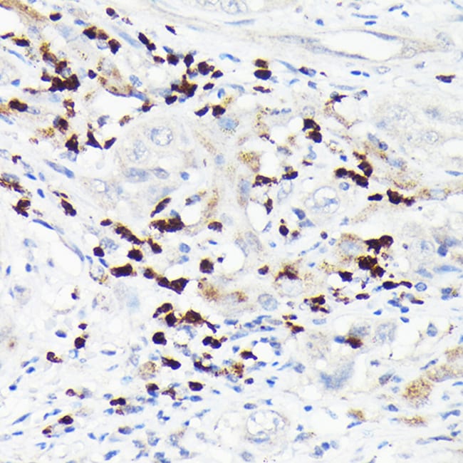 100UL MMP8 ANTIBODY 100 ul