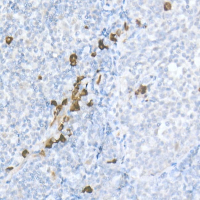 100UL MDC ANTIBODY 100 ul