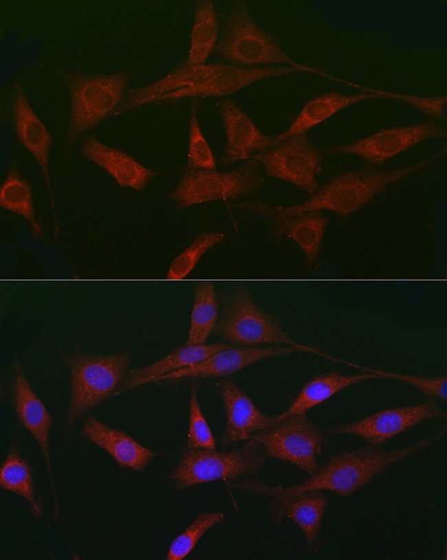 100UL ACVR2A ANTIBODY 100 ul