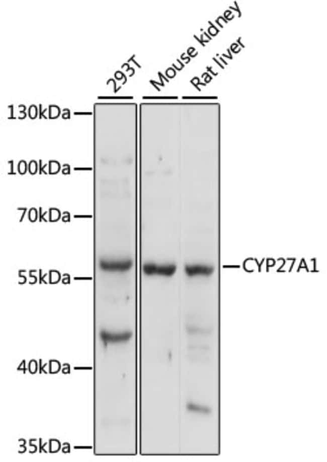 100UL CYP27A1 ANTIBODY 100 ul