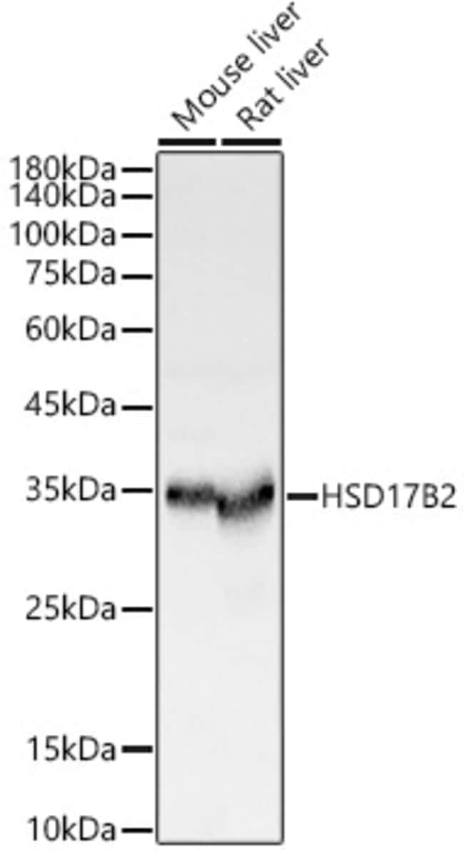 100UL HSD17B2 ANTIBODY 100 ul