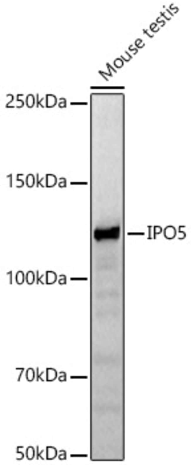 100UL IPO5 ANTIBODY 100 ul