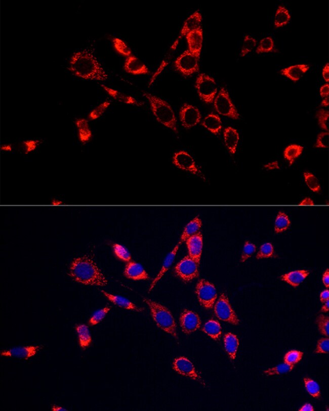 100UL CDA ANTIBODY 100 ul