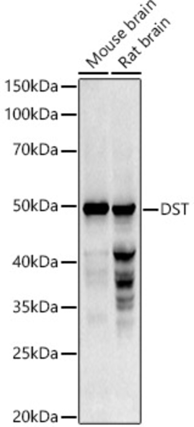 100UL DST ANTIBODY 100 ul