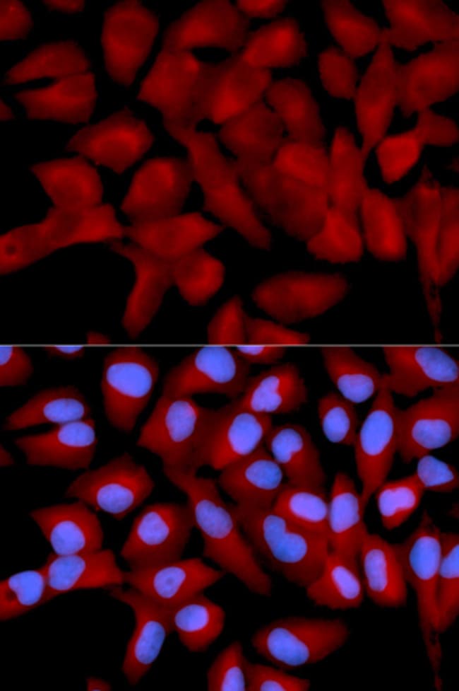 100UL EIF5A ANTIBODY 100 ul
