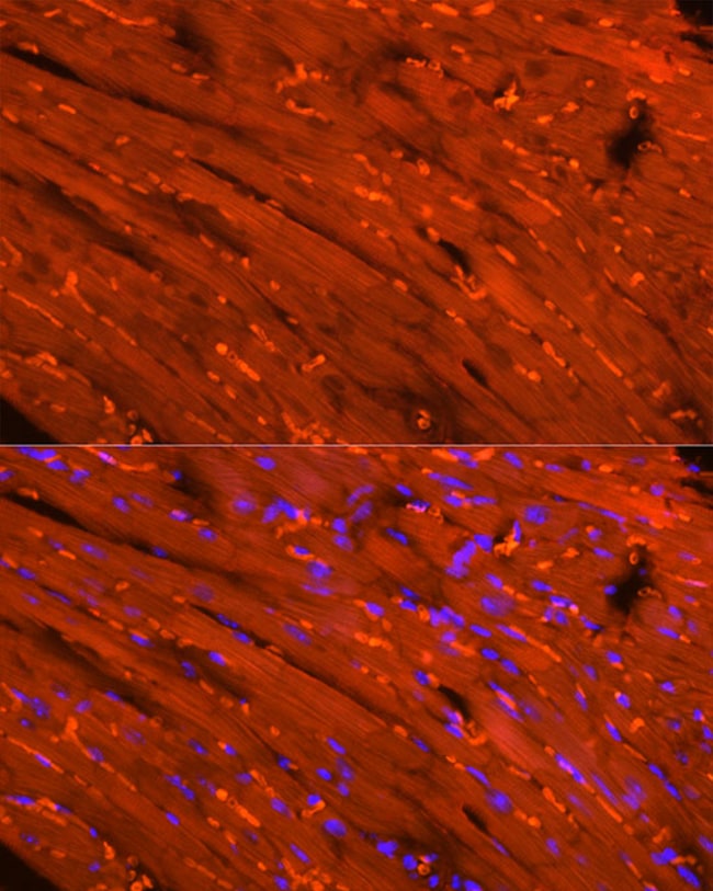 100UL CREATINE KINASE MB ANTIBODY 100 ul