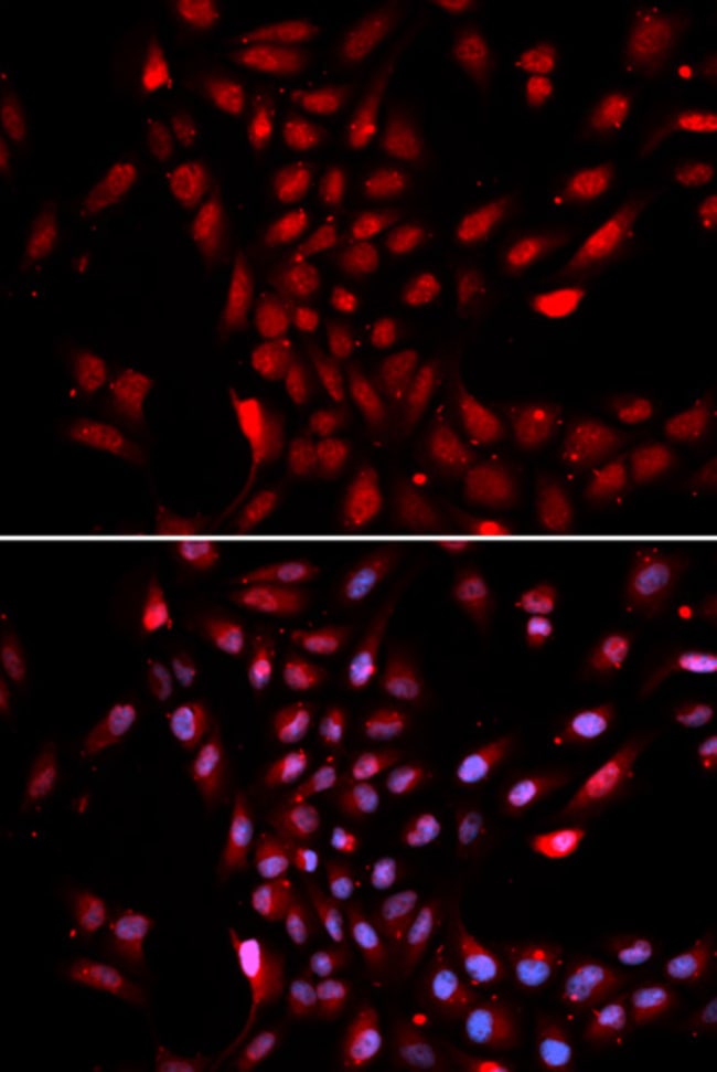 100UL KPNA4 ANTIBODY 100 ul