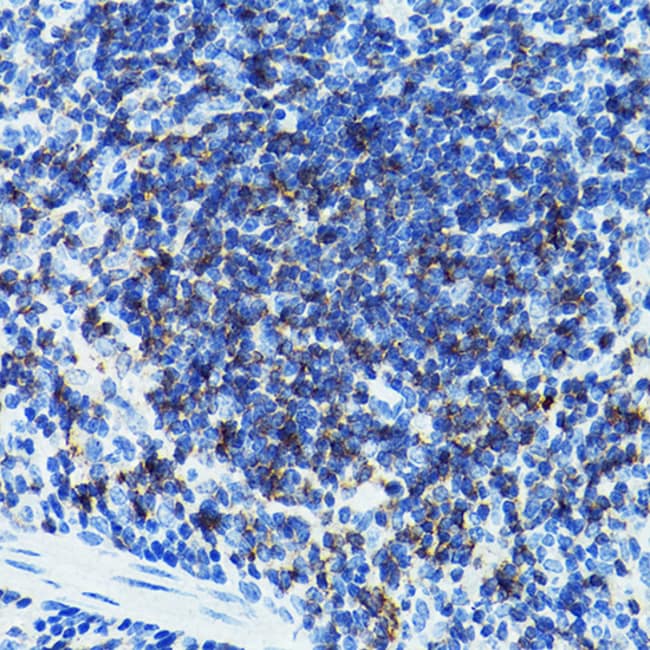 100UL CD79B ANTIBODY 100 ul