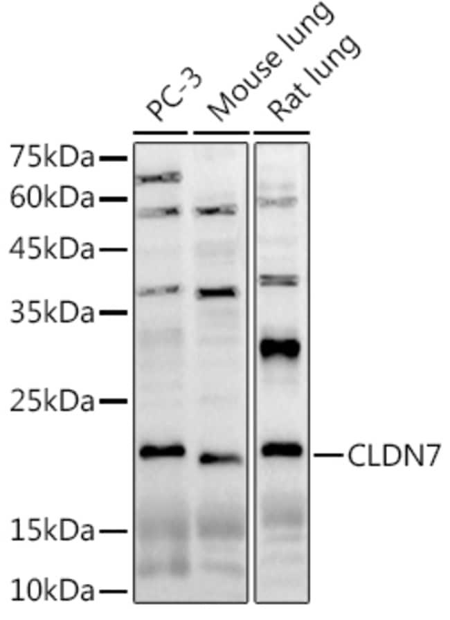 100UL CLAUDIN 7 ANTIBODY 100 ul