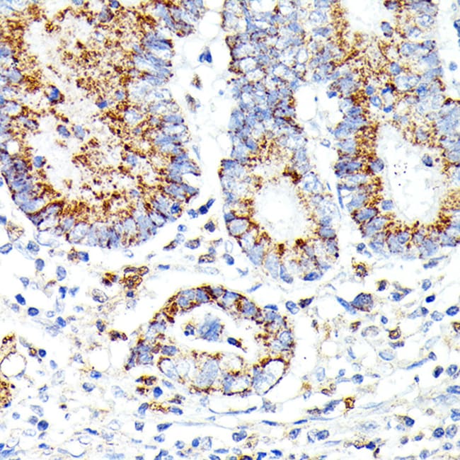 100UL IL13RA2 ANTIBODY 100 ul