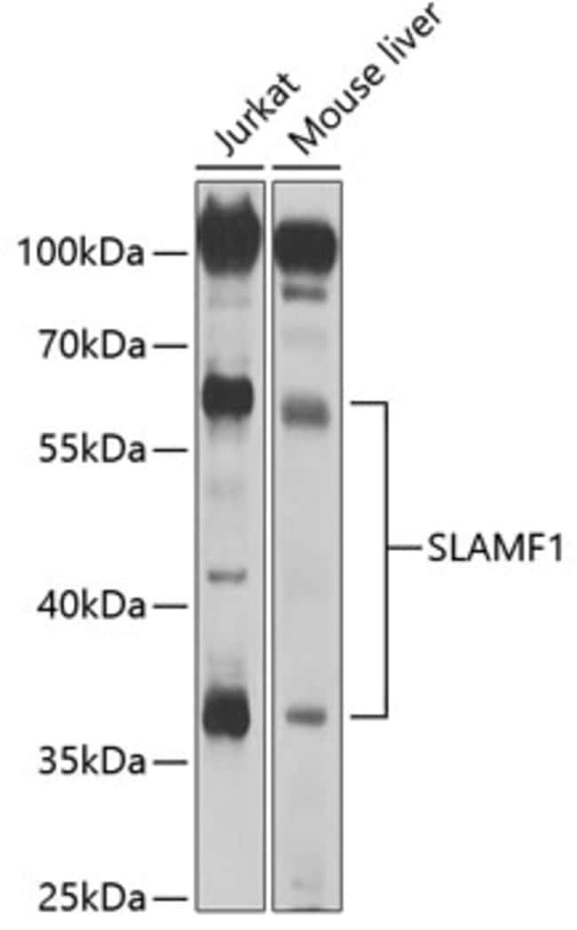 100UL CD150 ANTIBODY 100 ul