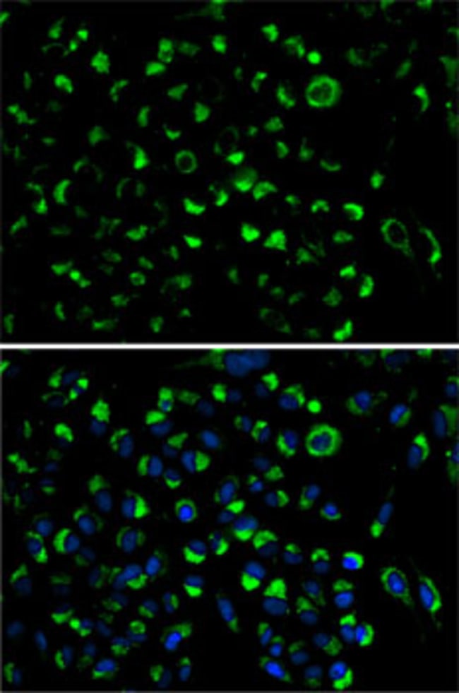 100UL ADENYLATE KINASE 4 ANTIBODY 100 ul