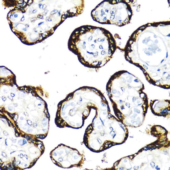 100UL FGFR2 ANTIBODY 100 ul